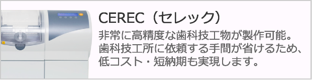 セレックの特徴